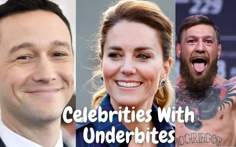 Celebrities-With-Underbites
