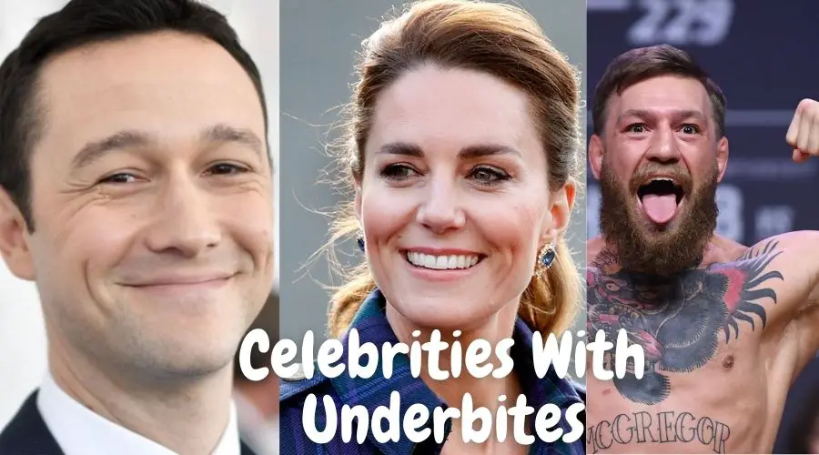 Celebrities-With-Underbites