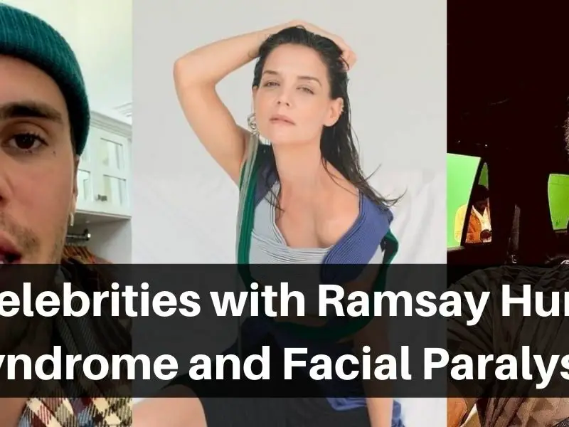 Celebrities-with-Ramsay-Hunt-Syndrome-Facial-Paralysis